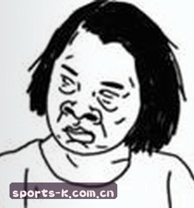 赵哥